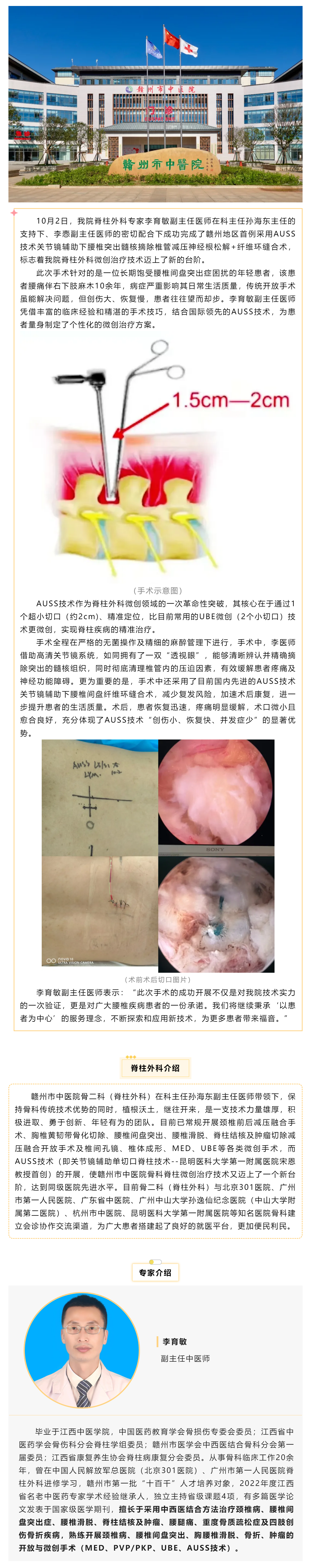 全市首例！我院成功实施AUSS技术关节镜辅助下腰椎突出髓核摘除椎管减压神经根松解+纤维环缝合术.png