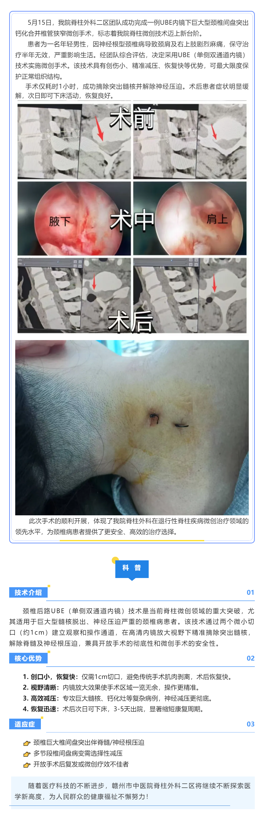 当天手术→次日下床：UBE技术让颈椎病康复快3倍！.png