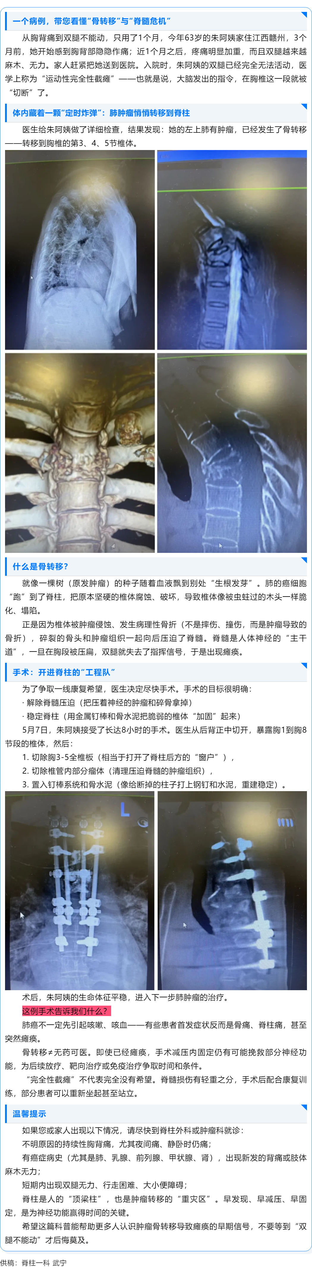 一&ldquo;脊&rdquo;绝尘：一位63岁阿姨瘫痪背后的真相.png