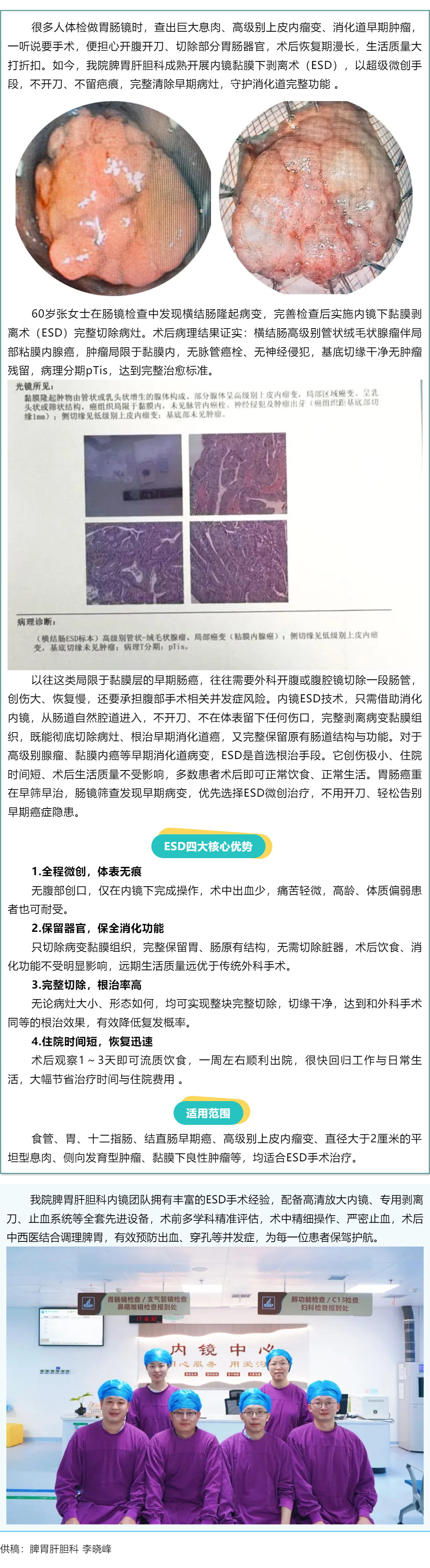 【新技术】ESD内镜微创手术，守住肠癌早期生命线.png