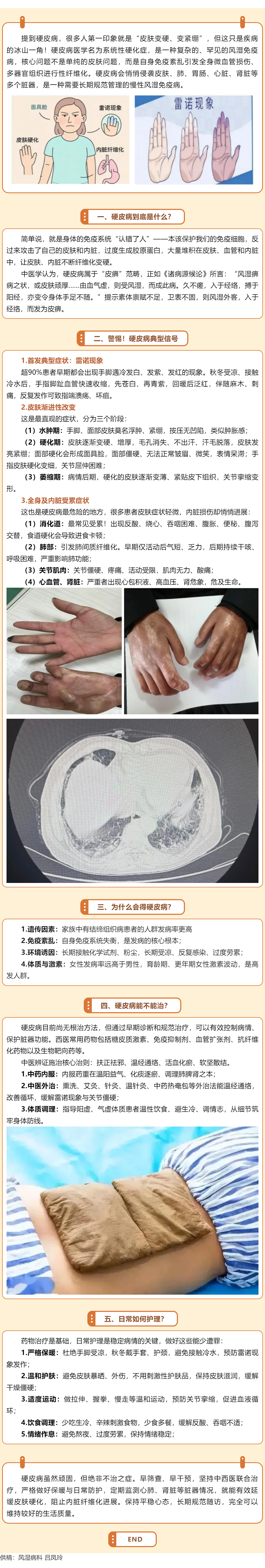 不止皮肤变硬！带你读懂罕见自身免疫病：硬皮病.png